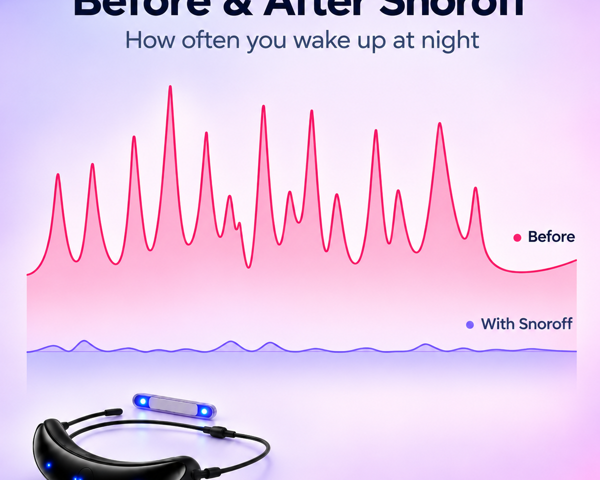 Snoroff™ Smart Anti-Snore Device